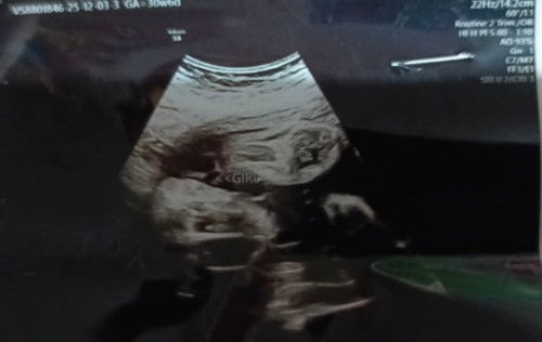 Sure Girl na po kaya? 😁