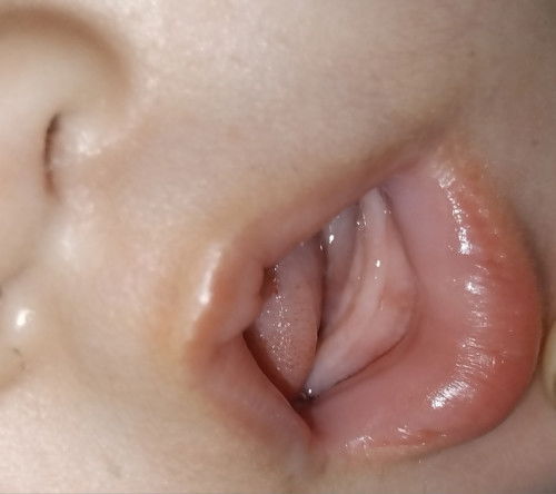 ฟันคู่แรกจะขึ้นหรือยัง