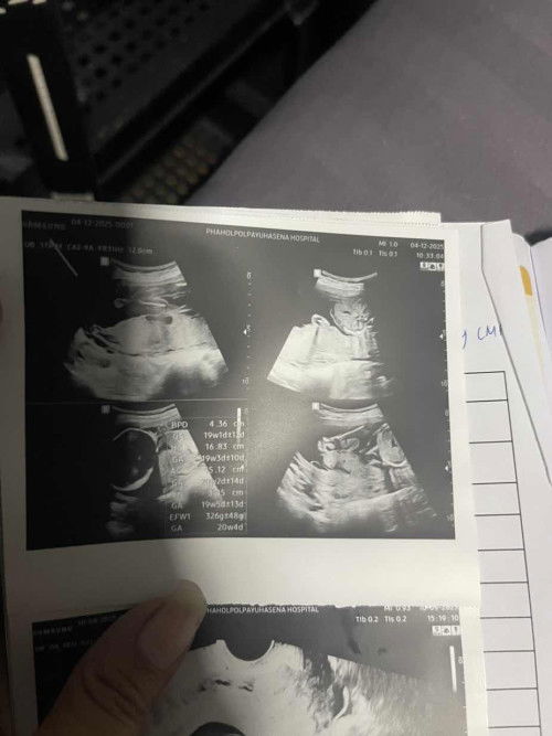 สอบถามแม่ๆค่ะ