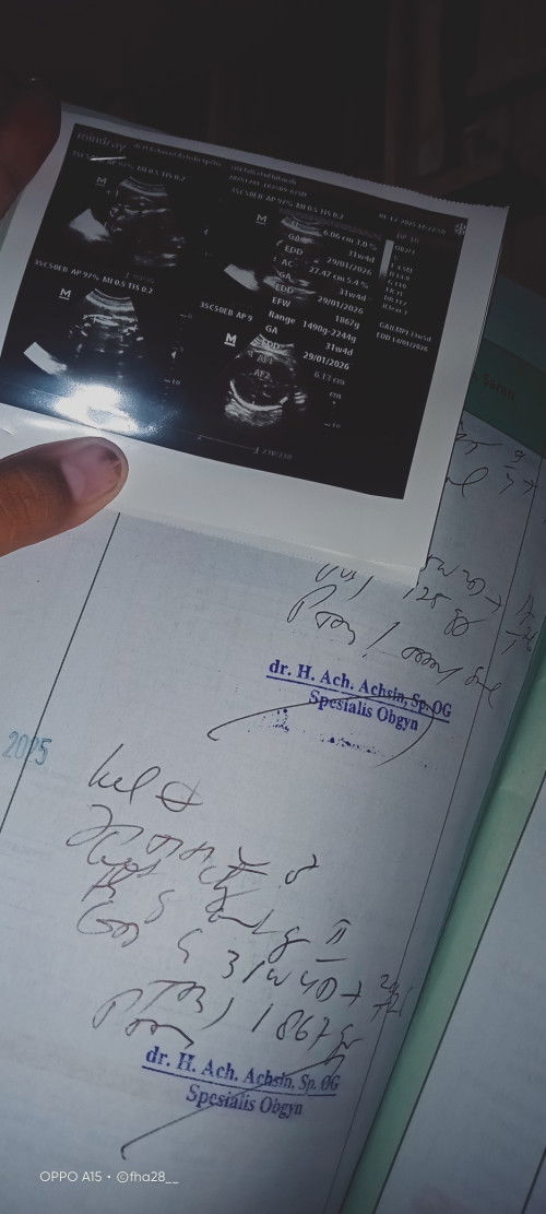 Cara mengetahui jenis kelamin bayi bun