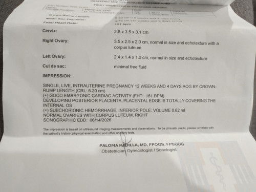 hi mga Mii pwede Po Ako Pa help about my trans V.