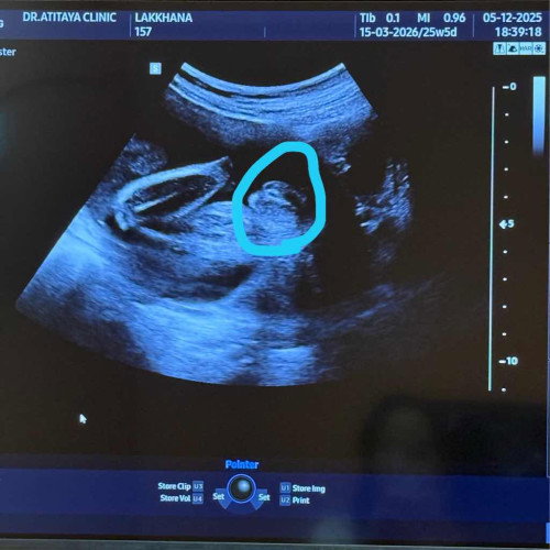 แม่ๆช่วยดูหน่อยค่ะ แบบนี้ ชหรือญคะ