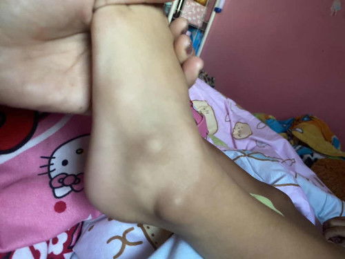 สอบถามเท้าเด็กหน่อยค่ะ