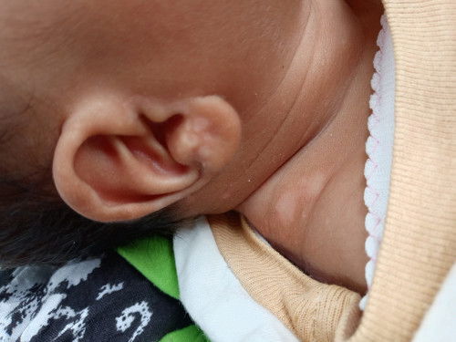 Bunda² mau tanya dong