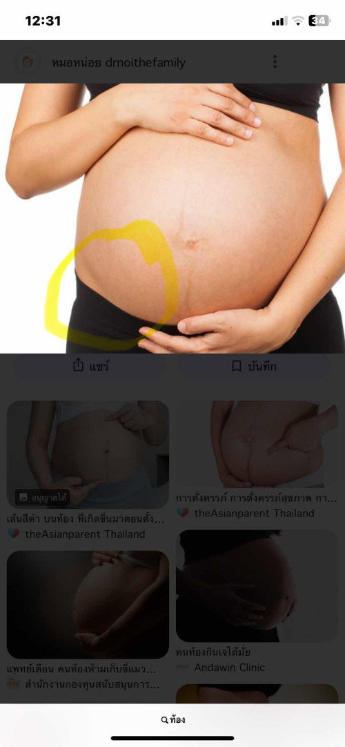 เจ็บท้องหน่วงมาก ร้าวไปถึงจิมิเลย เป็นอะไรคะ