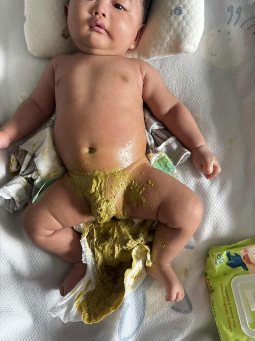 อึแบบนี่เป็นปกติไหม เด็กก3เดือน