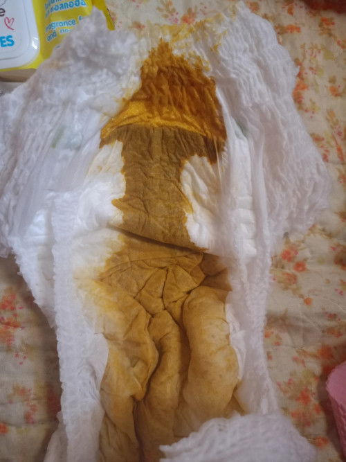 ขออนุญาตค่ะแม่ๆ