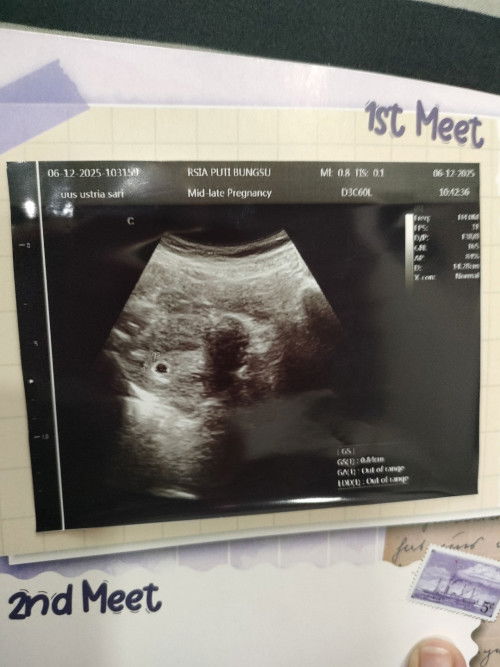 Ada yg sama ngga ya bun