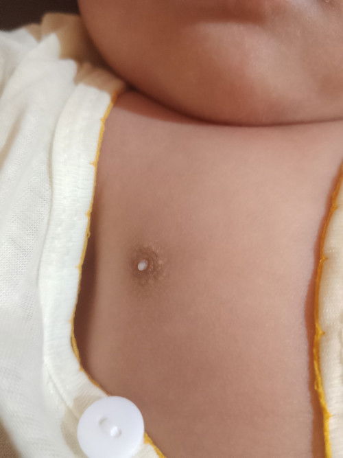 Bintik putih pada puting bayi