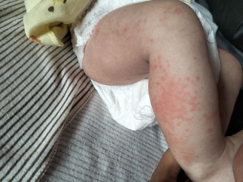 Ada yang pernah ngalamin?