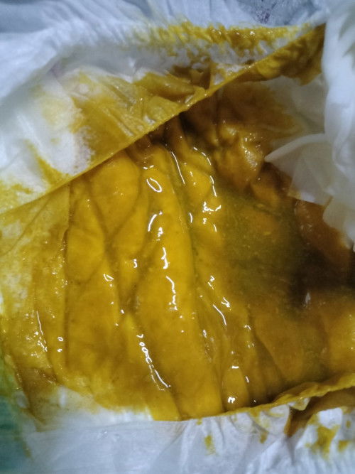 อึทารก2เดือน4วันแบบนี้ถ่ายเหลวหรือปกติ