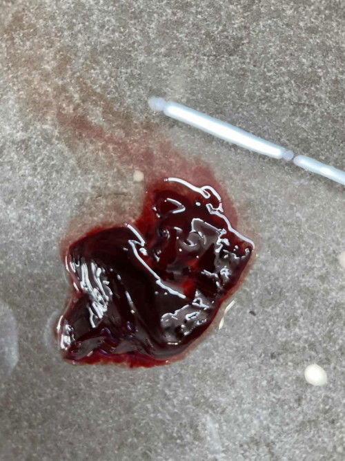 korang ada pengalaman  bleeding tak