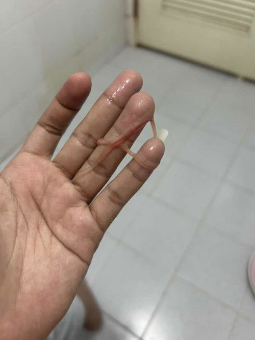 มีมูกเลือดออกแต่ไม่ปวดท้องครวไปหาหมอดีไหมค่ะ