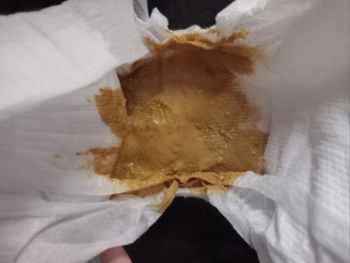 อึดลูกเเบบนี้ปกติไม่ค่ะ