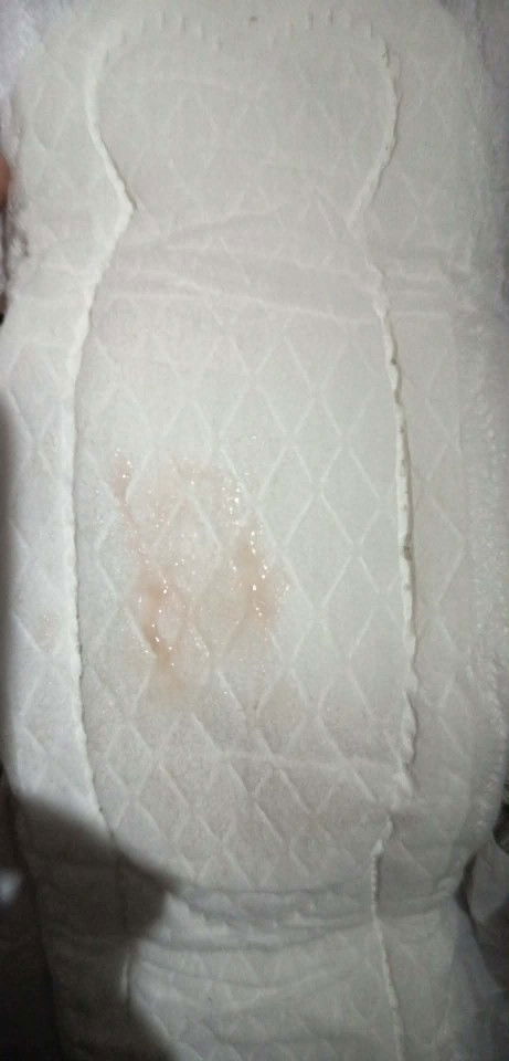 มีมูกเลือด