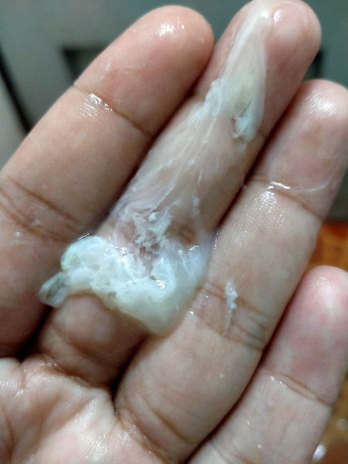 ตกขาวเยอะมาก