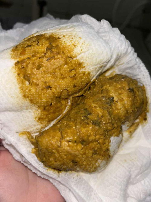 Mom plis bingung bgt, adakah yg prn begini pup baby nya? Cacing bukan ya?