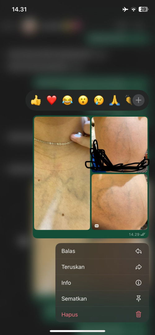 28minggu urat terlihat jelas