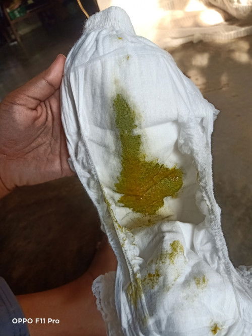 สีอึลูกน้อย