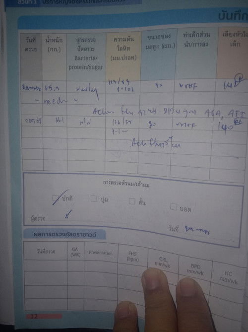 ท่าของเด็กในครรภ์