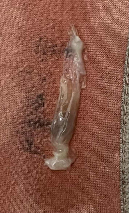 Tanda bersalin
Hi nak tanya kalau keluar keputihan san lebdir tp tak bau mcm gmbrpada 32w normal ke?