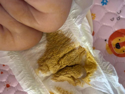 น้องถ่ายแบบนี้ปกติมั้ยคะแม่ๆ