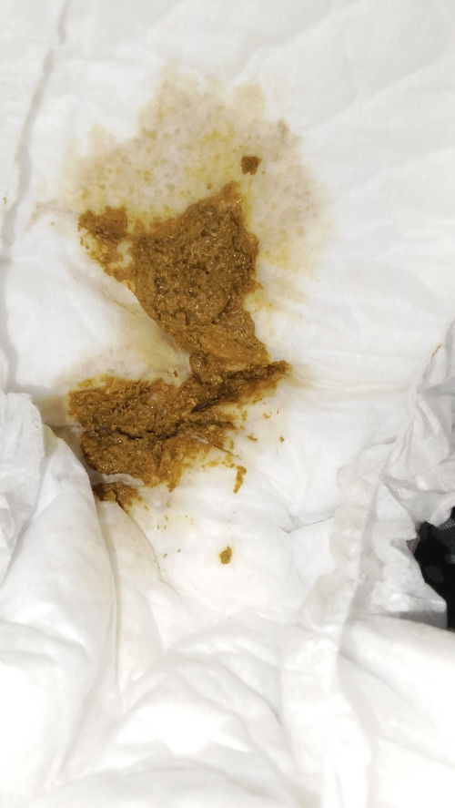 ขอสอบถามแม่ๆ