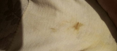 36weeks and 4days ano po kaya ito paggising ko may ganito na po sa panty ko🥹