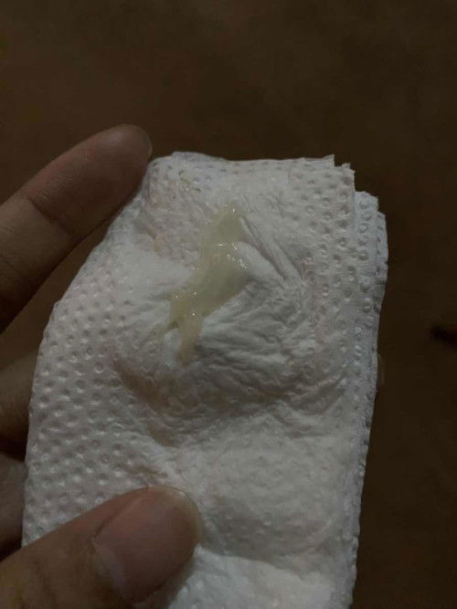 มูกหรือตกขาว?