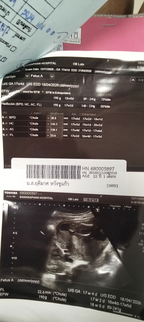 ขอถามแม่ๆหน่อยค่ะ