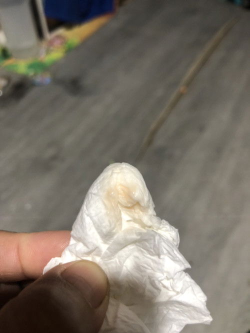 ท้อง 7 สัปดาห์