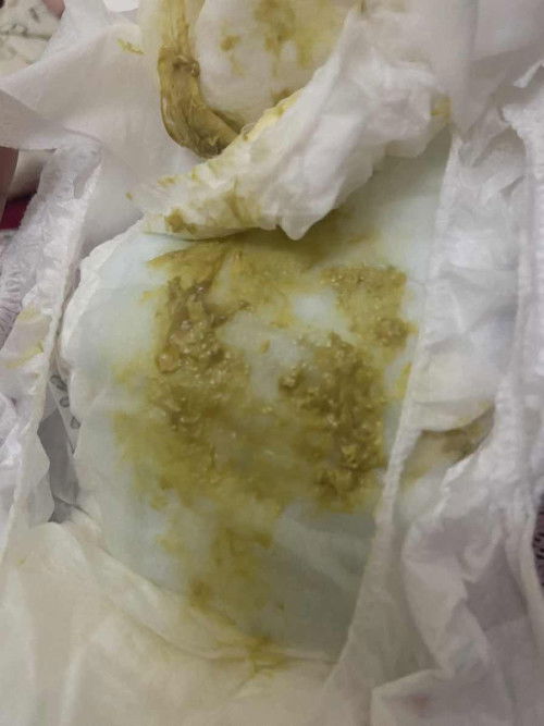 ni cirit birit ke bukan?