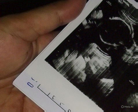 Kira-kira cewe apa cowo Bun?