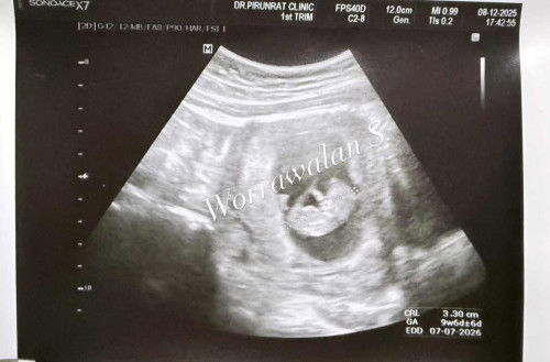 ♡คุณแม่เดือนกรกฎาคม2569♡