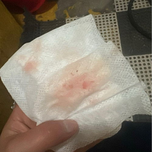 ท้องไหมคะ อยากมีน้อง