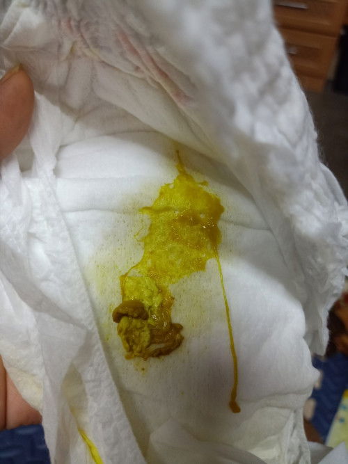 ถ่ายแบบนี้ปกติไหมคะ