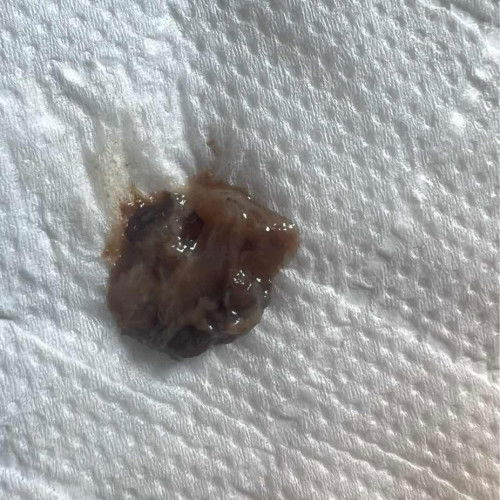 39 w หมอนัดกระตุ้นคลอด