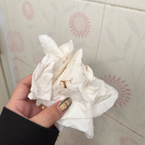 ตั้งท้องได้ 9สัปดาห์ 4วัน