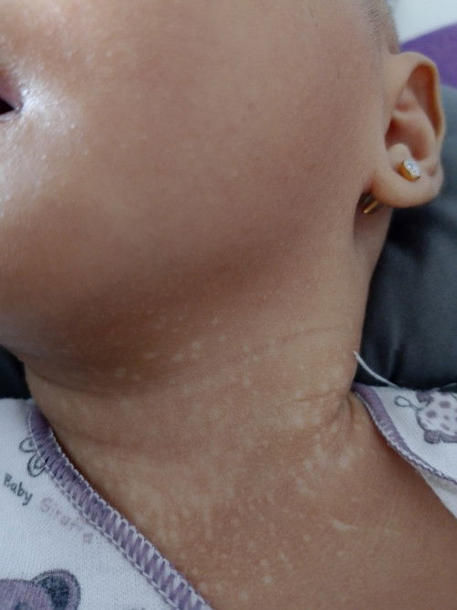 Bekas dan bintik putih