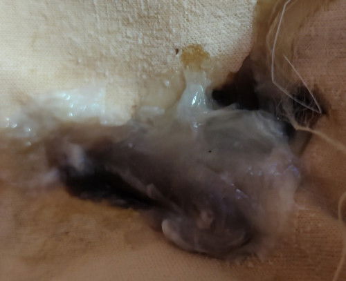 มีมูกเลือดก้อนใหญ่มากค่ะ ปวดท้องหน่วงๆ แต่ไม่ถี่