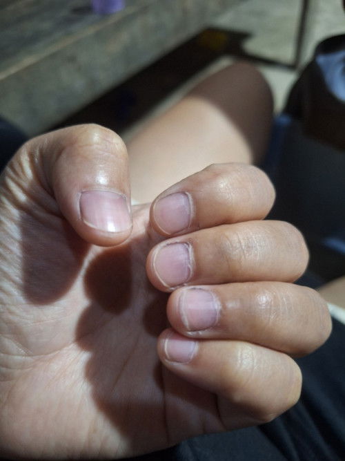 สีเล็บปกติมั้ยคะ