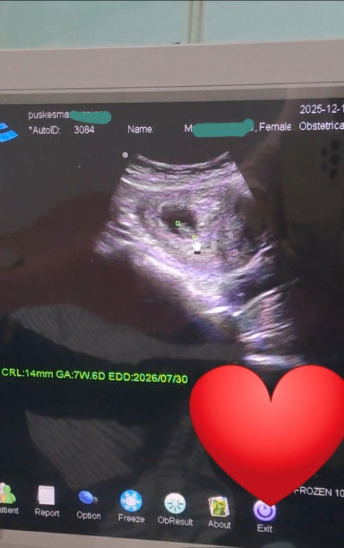 Hasil USG 7week