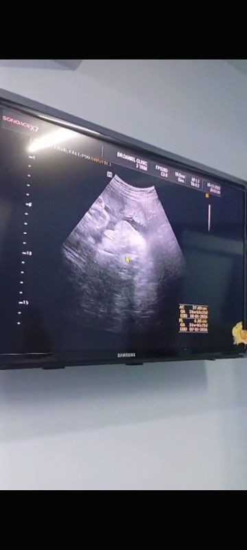 มีคนบอกมกราคม69ผ.ชมาแรง