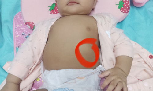 Mga moshie usli din po ba ung left rib Ng baby nyo normal lang po un?