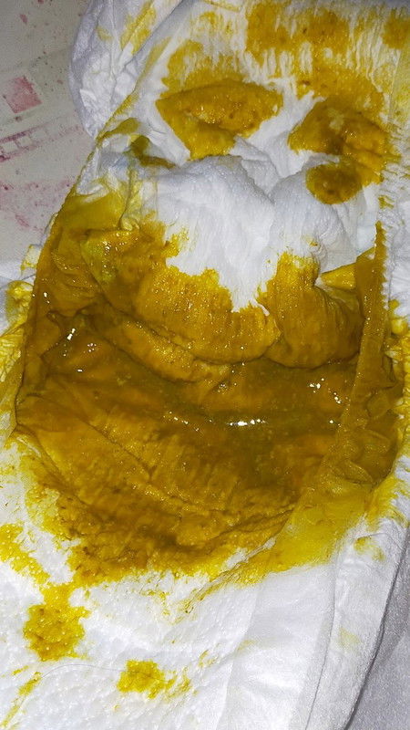 Bab anak 2 bulan 4 hari