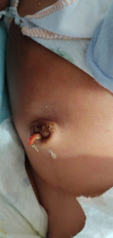 ขอคำแนะนำหน่อยค่ะ