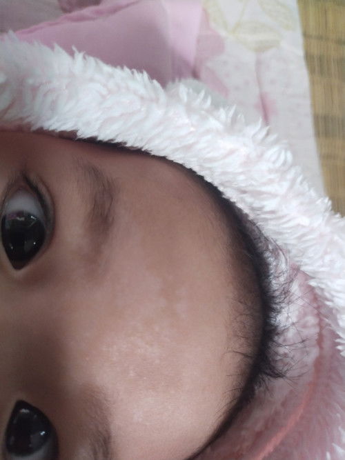 น้องได้4เดือน