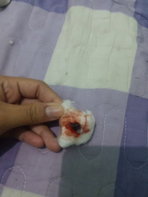 Ini kenapa ya keluar darah