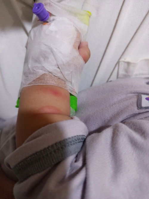 Bahayanya pneumonia anak 3 bulan akibat rokok