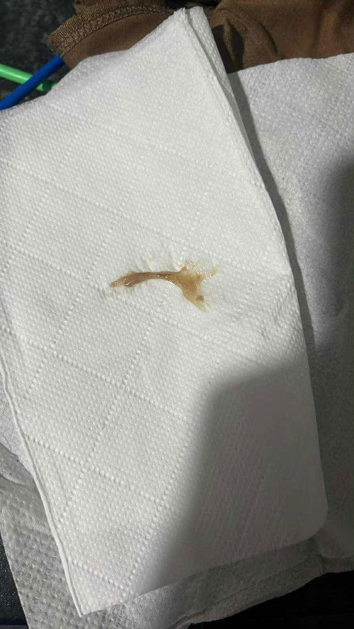 ขออนุญาตสอบถามคะแม่ๆ